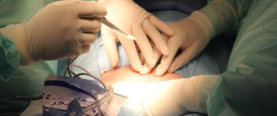Израильские медики впервые провели повторную трансплантацию почки