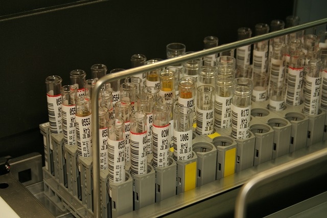 Израильские ученые: стволовые клетки можно использовать для восстановления легких