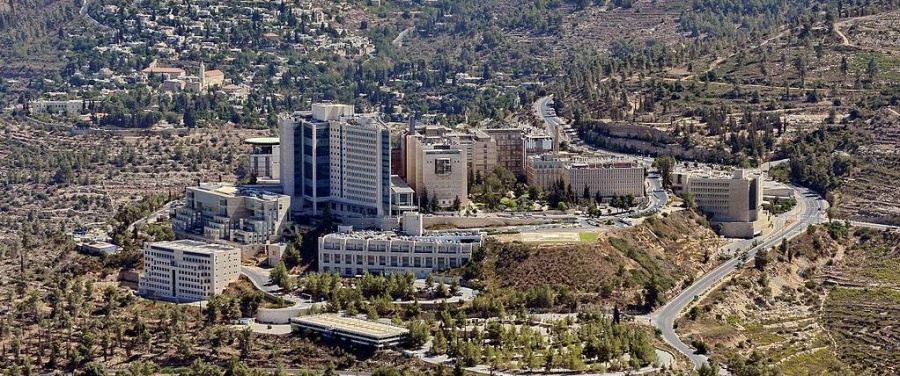 В Израиле пациентам пересадили зараженные донорские органы